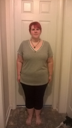 9-month-post-op-full-front-view
